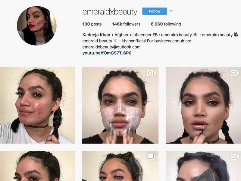 Kadeeja Khan - The Skincare Instagrammers For Who Are Struggling With Cystic Acne.