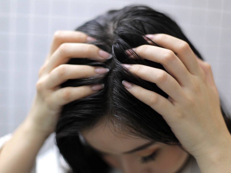 Tip No2 To Get Rid Of Dandruff: Only The Scalp 