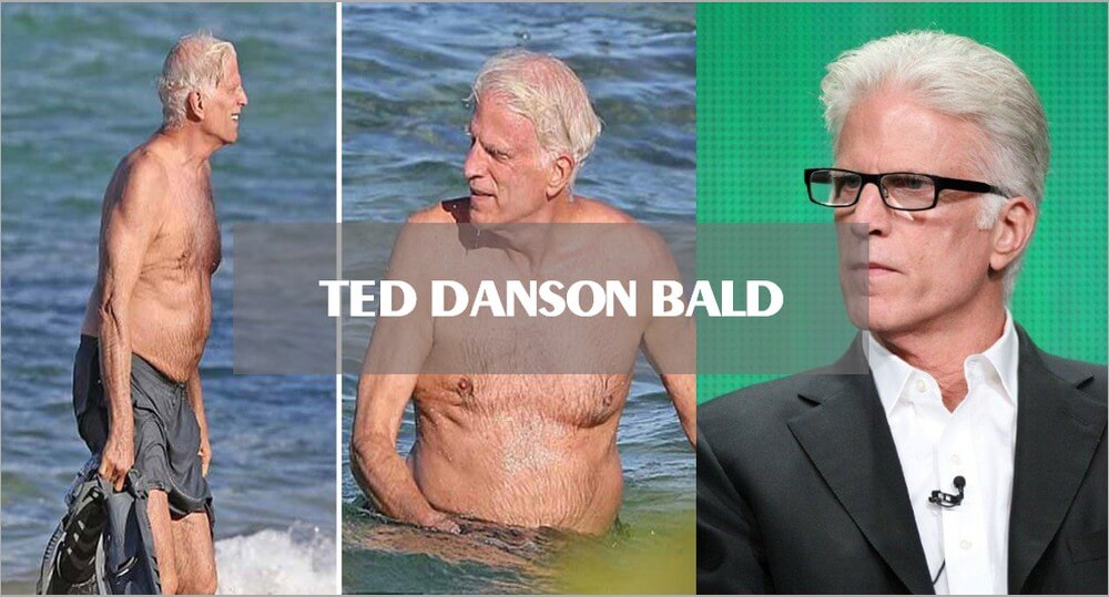 Ted Danson bald 1