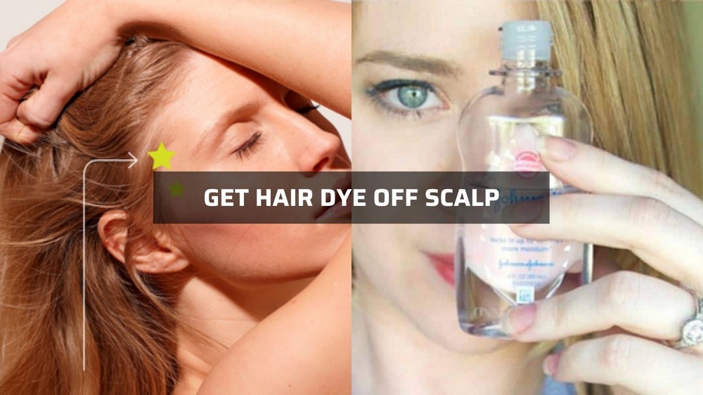 how-to-get-hair-dye-off-scalp-but-not-hair-2