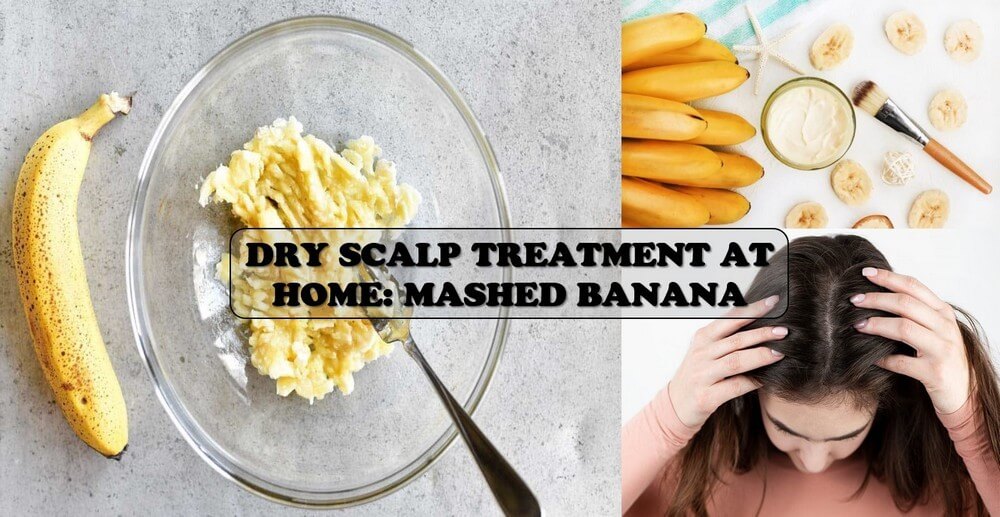 dry-scalp-treatment-at-home-10