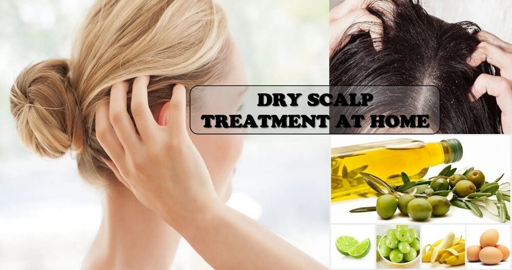 dry scalp treatment at home 1 1