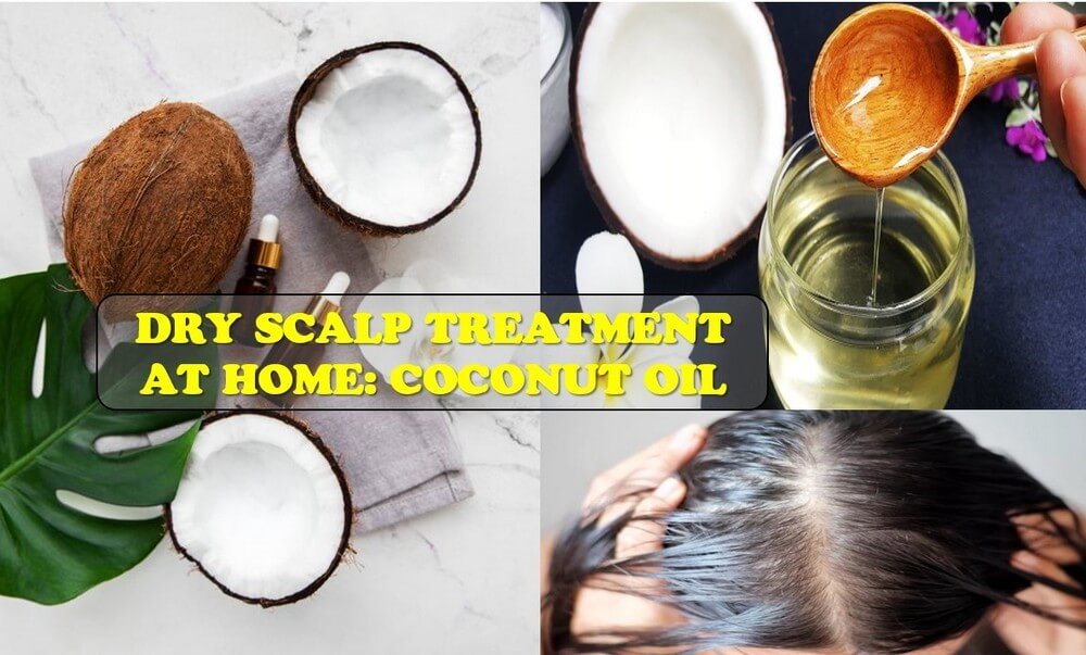 dry-scalp-treatment-at-home-8
