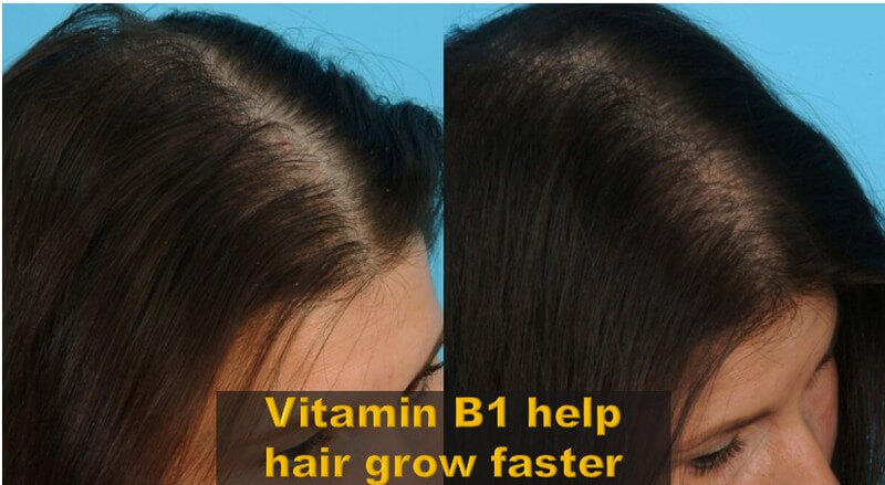 How-to-grow-hair-faster-for-women_13