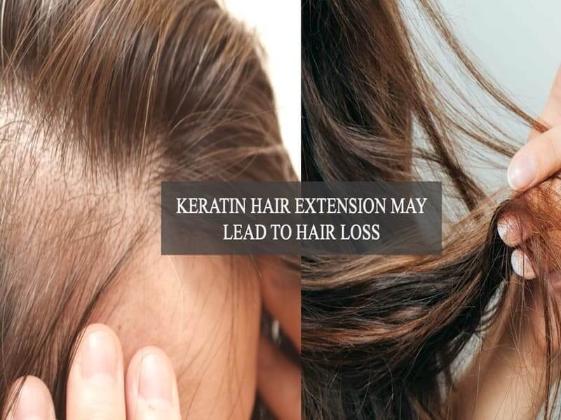 Keratin-hair-extension-may-lead-to-hair-loss